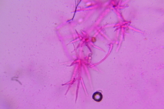 Mycogone calospora