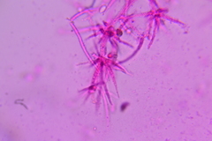 Mycogone calospora