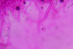 Mycogone calospora