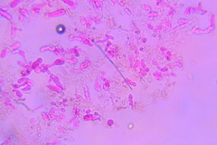 Clitopilus scyphoides