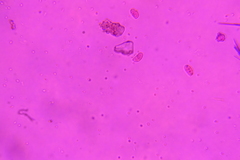 Dacrymyces minor
