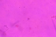 Dacrymyces minor