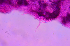 Hypomyces chlorinigenus