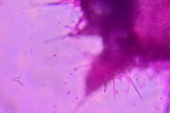 Hypomyces chlorinigenus
