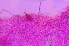 Hypomyces chlorinigenus