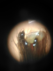 Plesiopelma