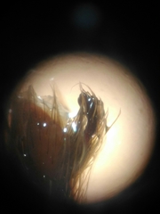 Plesiopelma