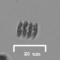 Scenedesmus