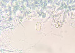 Truncospora