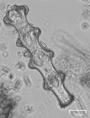 Pleurotaenium nodosum