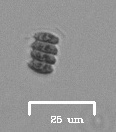 Scenedesmus