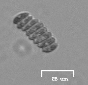 Scenedesmus