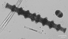 Pleurotaenium nodosum