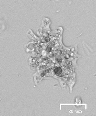 Amoeba