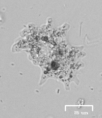 Amoeba