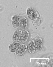 Willea irregularis