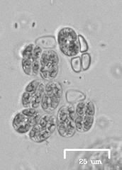 Willea irregularis