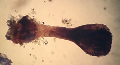 Stenocybe