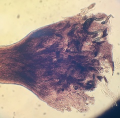 Stenocybe