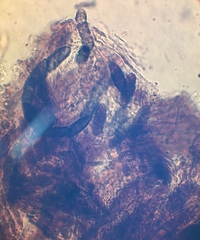Stenocybe