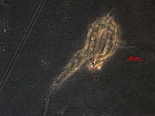 Harposporium