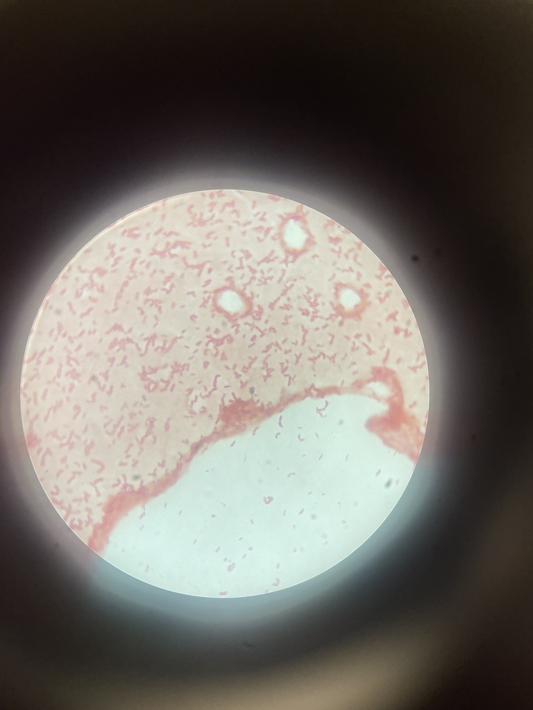Bacillus subtilis