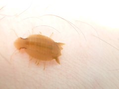 Amphoroidea media