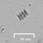 Scenedesmus
