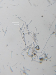 Isodictya deichmannae