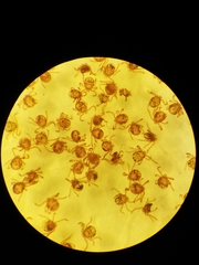 Haemaphysalis longicornis