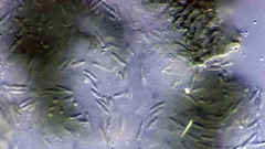 Pseudophaeophleospora