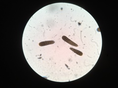 Berkleasmium concinnum