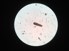 Berkleasmium concinnum