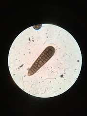 Berkleasmium concinnum