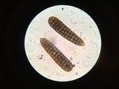 Berkleasmium concinnum