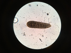 Berkleasmium concinnum