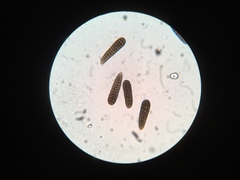 Berkleasmium concinnum