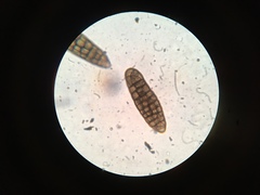 Berkleasmium concinnum