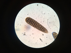 Berkleasmium concinnum