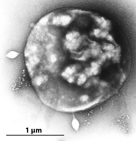 Archaebacteria Kingdom Facts