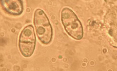 Dialonectria episphaeria