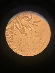 Dialonectria episphaeria