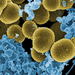 Staphylococcus aureus - Photo (c) Microbe World, algunos derechos reservados (CC BY-NC-SA)