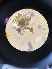 Phaeocalicium flabelliforme