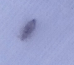 Pediculus humanus capitis