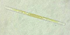 Ulnaria ulna