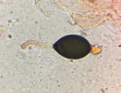 Podospora pleiospora