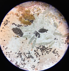 Podospora pleiospora