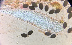 Podospora pleiospora