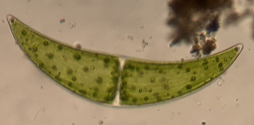 Closterium ehrenbergii, 2025-05-31